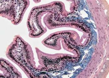 Νέα μελέτη εξηγεί τη σύνδεση ανάμεσα στην κατανάλωση UPFs τροφίμων και του καρκίνου του εντέρου / Φωτ.: Unsplash