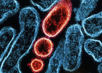 Σωματίδια του ιού Nipah / Φωτ.: NIAID Integrated Research Facility στο Fort Detrick, Maryland / Unsplash